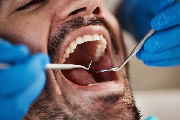 Best Periodontal (Gum) Disease Treatment  in Weslaco, TX